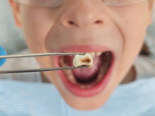 Best Walk-In Emergency Dental Services in Cumming, GA
